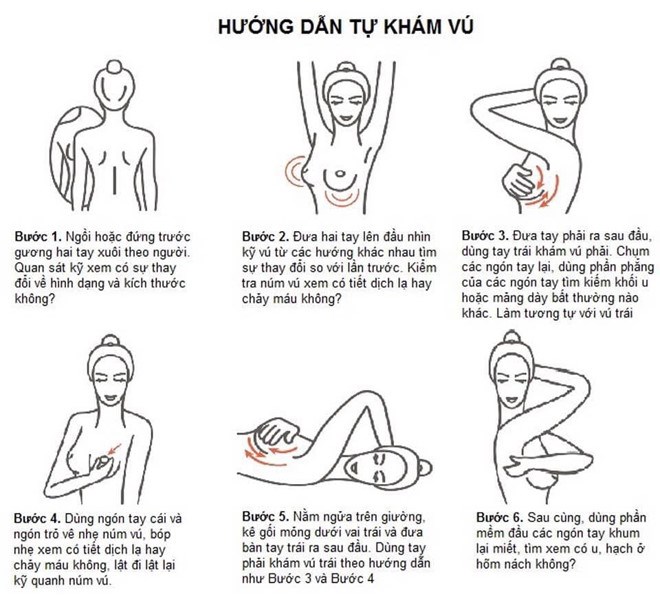 Ung thư vú và những điều bạn không nên bỏ qua