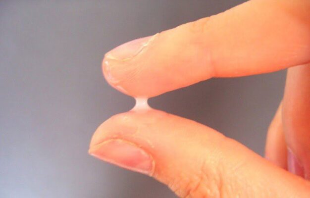 Khí hư loãng có mùi chua nhẹ, tanh cá