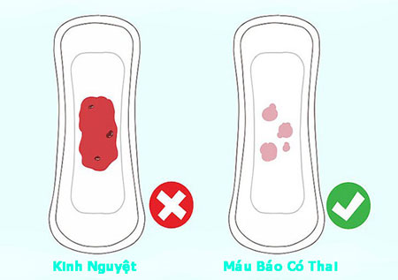 Phân biệt máu báo thai và máu kinh nguyệt